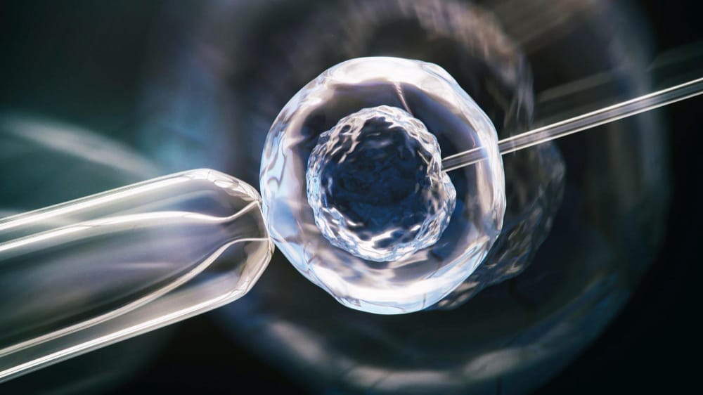 Fertility Treatments